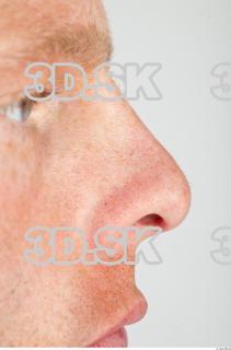 Nose texture of Alberto 0002